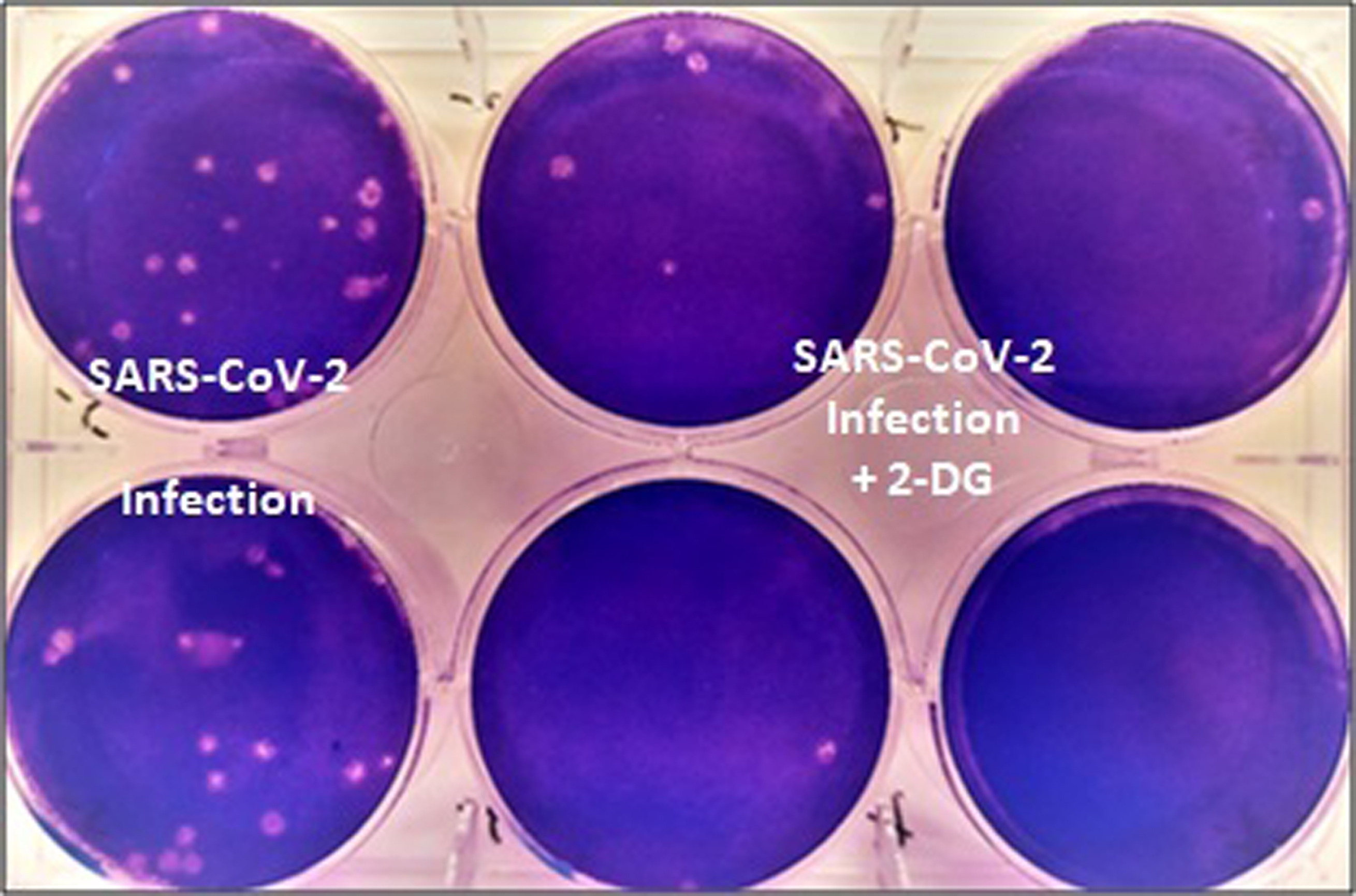 Anti-COVID drug developed by DRDO