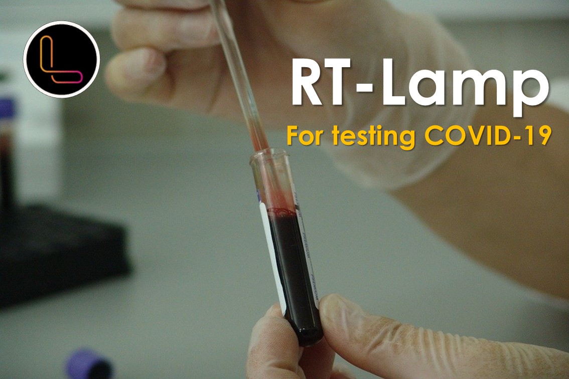 RT-LAMP: a new technology for detecting COVID-19