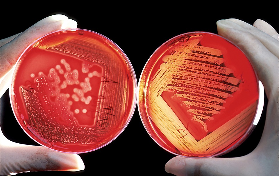 Anomalous behaviour of bacterial colonies