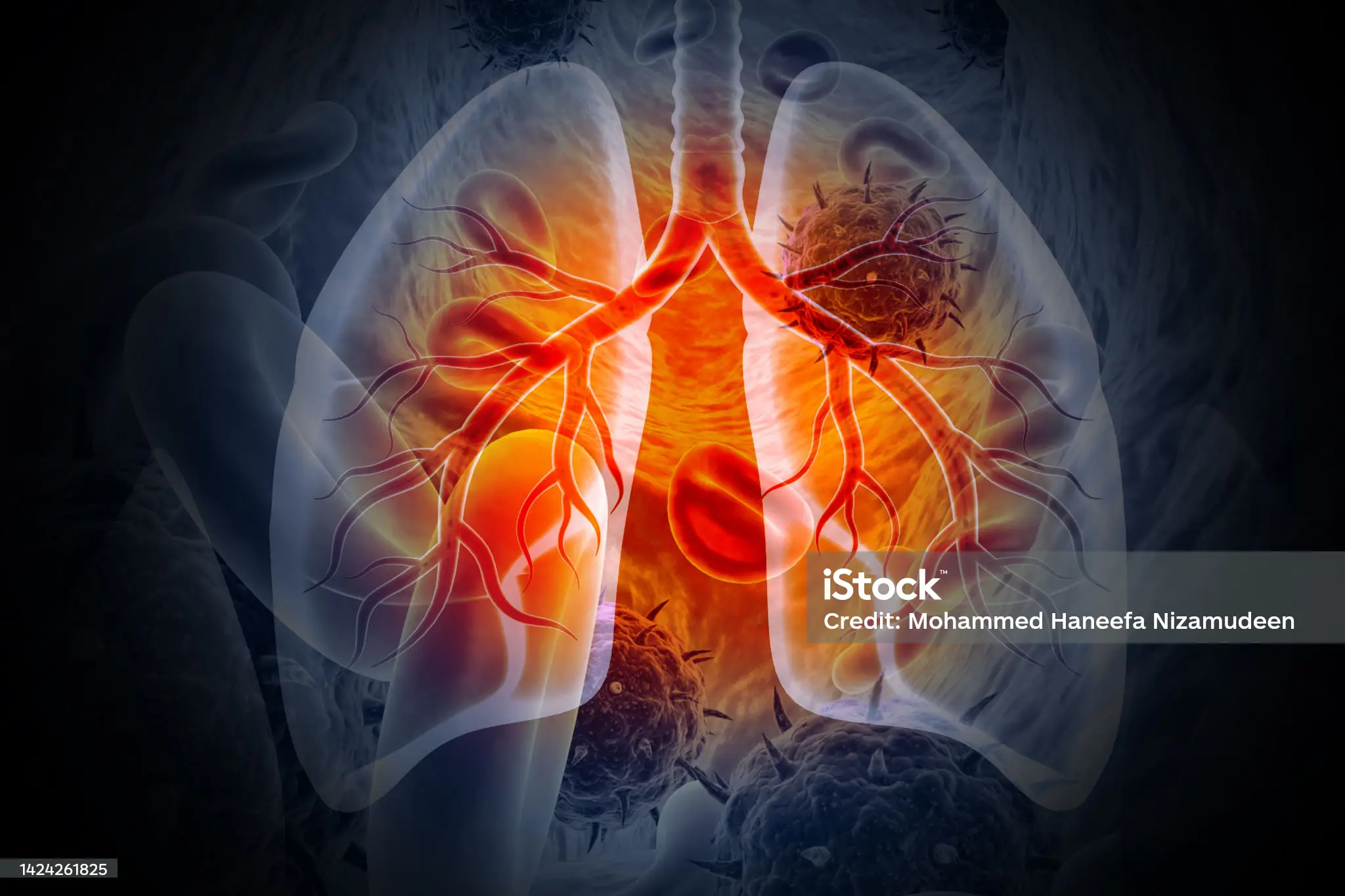 7.5 million new cases of TB in 2022: WHO report