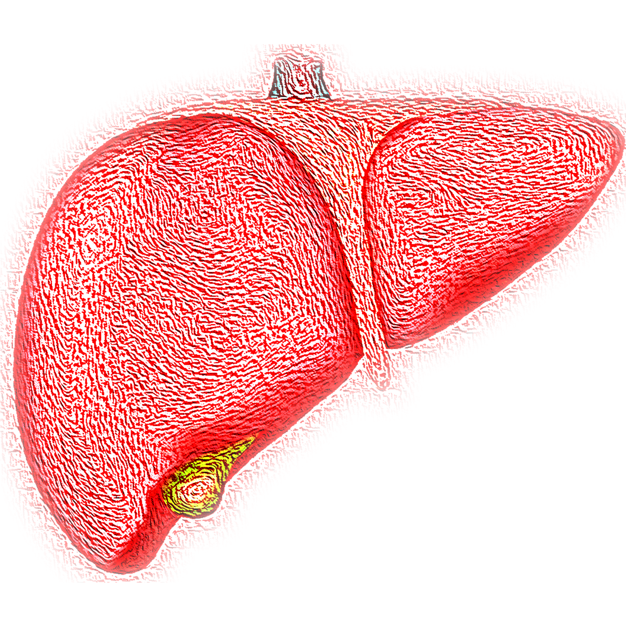 Egypt is racing to eliminate hepatitis C